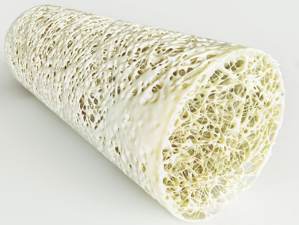 骨粗鬆症　カルシウム