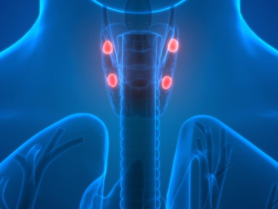 副甲状腺機能亢進症のイラスト