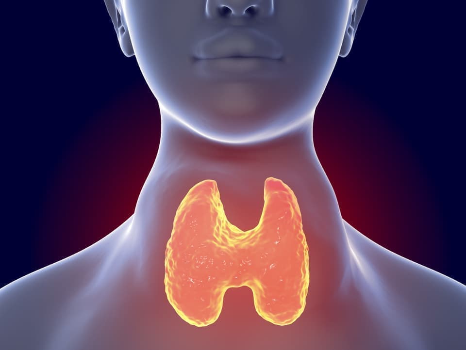 バセドウ病のイラスト