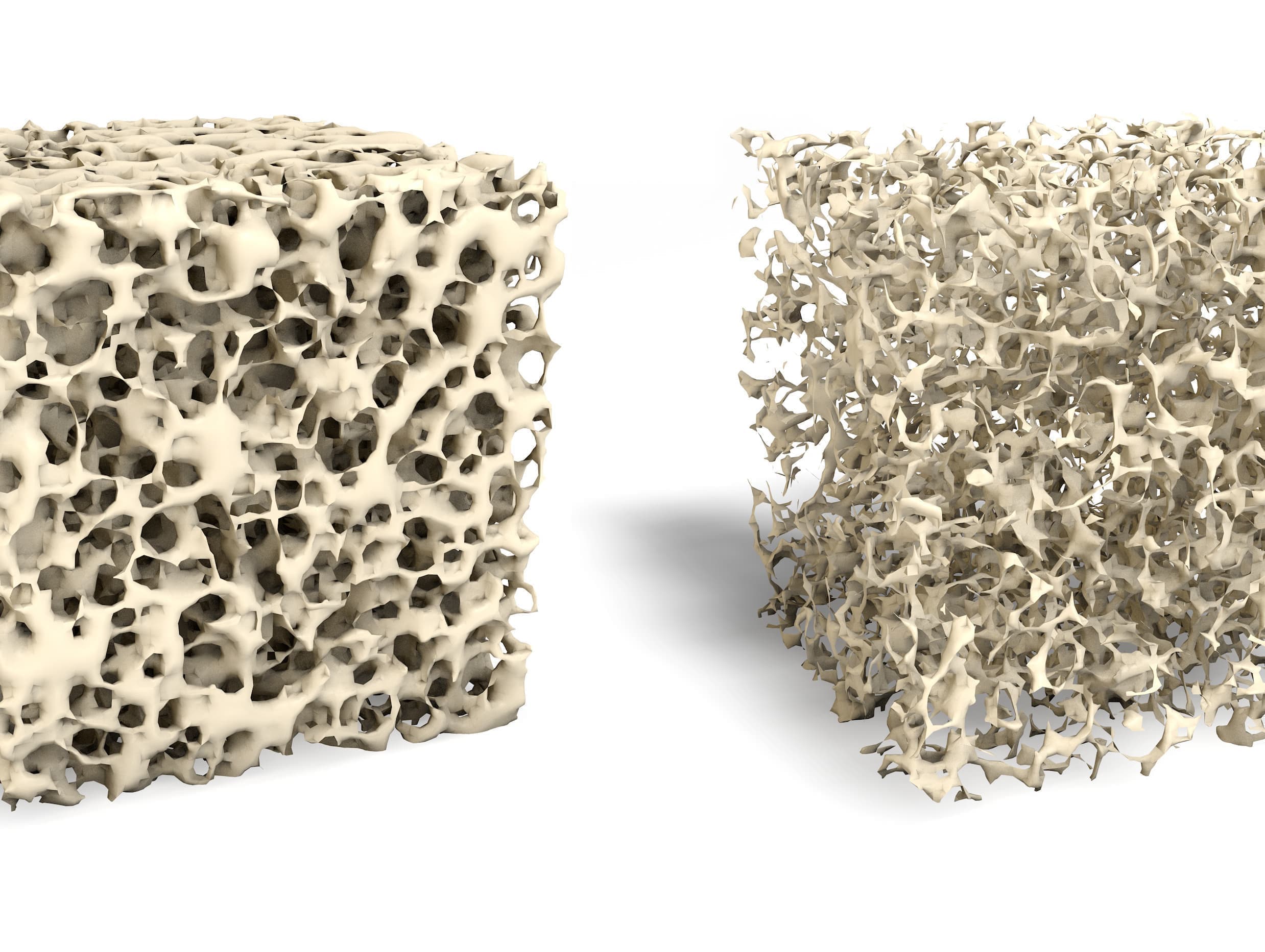 骨粗しょう症のイラスト