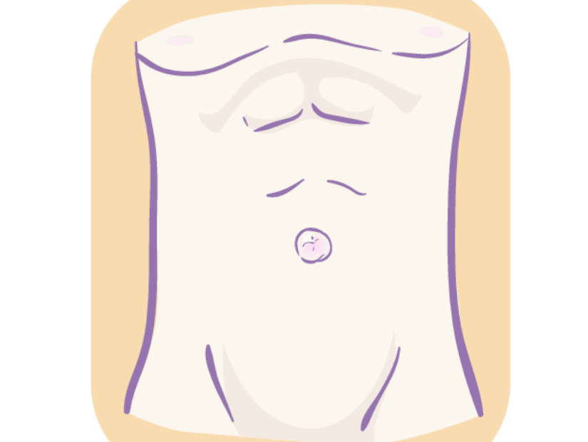 橋本病　甲状腺