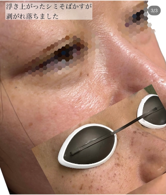 IPL効果_画像.03