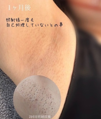 IPL効果_画像.10