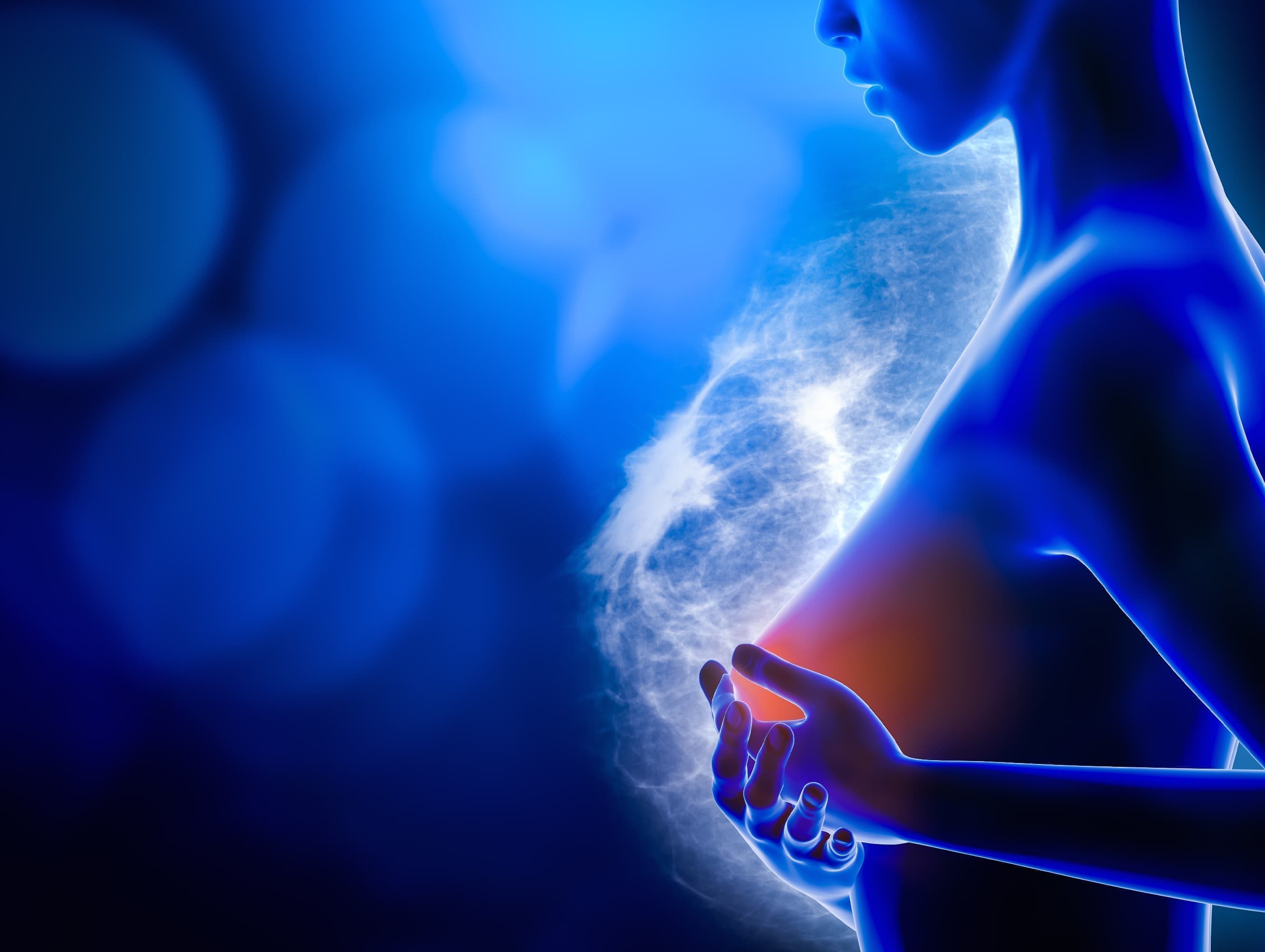 乳腺炎のイラスト