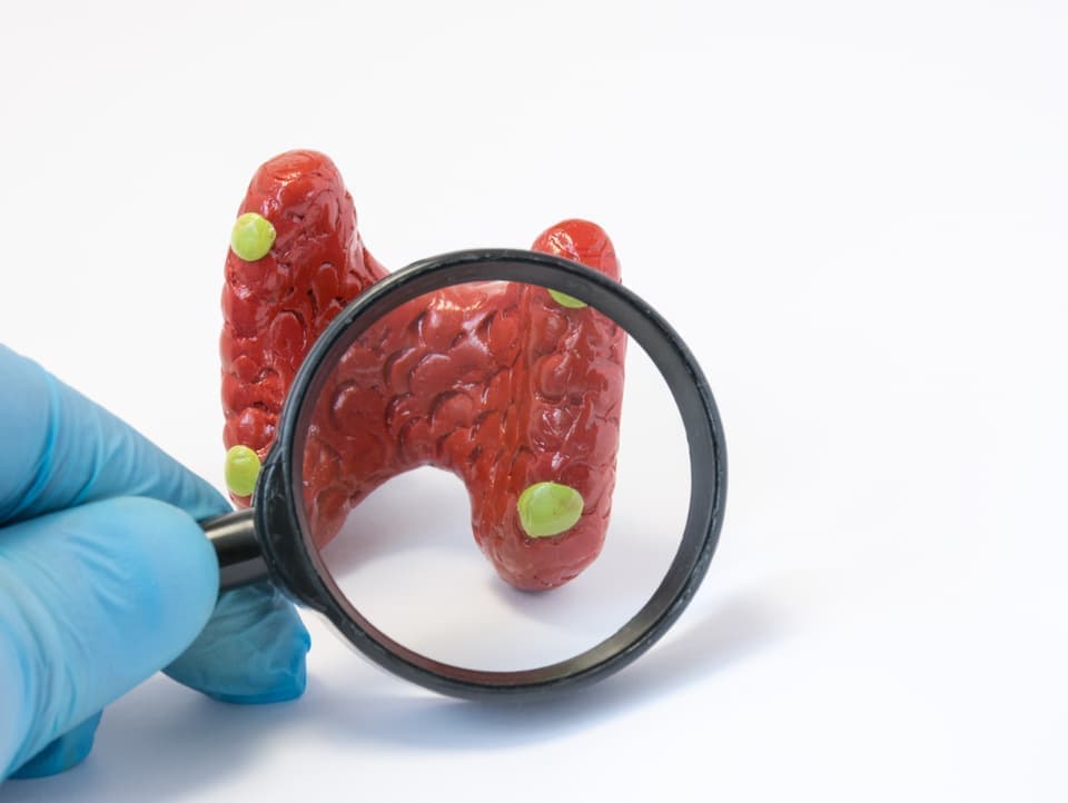 副甲状腺の検査治療